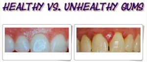 periodontics palm beach gardens