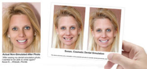 Complimentary Cosmetic Smile Imaging 
