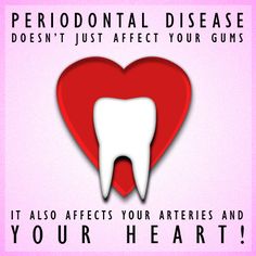 Periodontal (Gum) Disease Affects Your Heart b747cfc111b95c47b3ca0c319a58581b