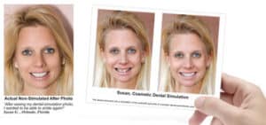 Complimentary Cosmetic Smile Imaging 