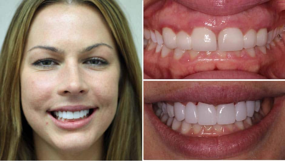 A female patient smiling with her before and after images next to her