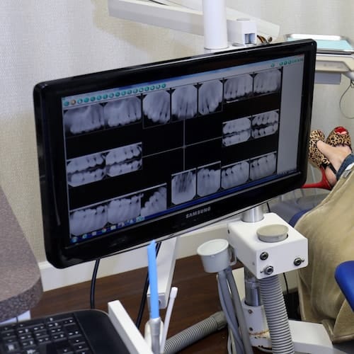 Modern Technology used by dentist in Palm Beach Gardens Dentists in Palm Beach Gardens use modern technology to bring exceptional results