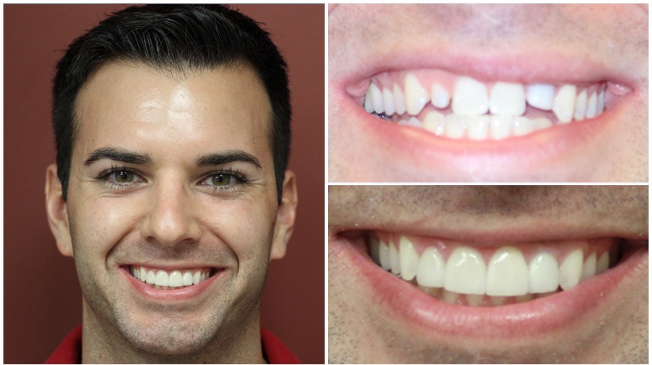 A male patient smiling with his before and after images next to him