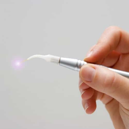 Restorative Dentistry Palm Beach Gardens - Laser Dentistry A laser used in Restorative Dentistry Palm Beach Gardens