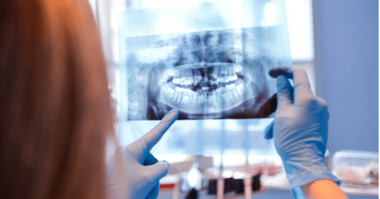 A dentist examining a dental x-ray