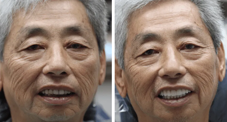 Collage: elderly man with a beautiful smile on the left and his photo before restoration on the right.